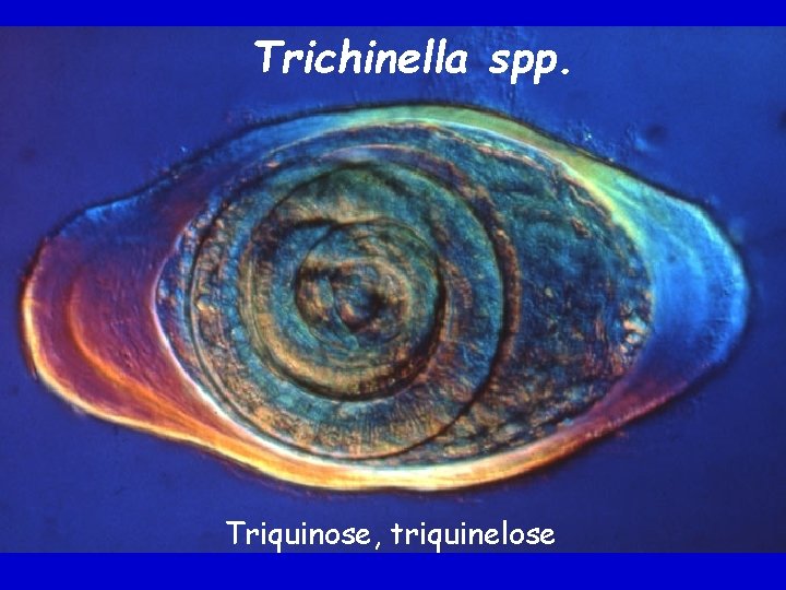 Trichinella spp. Triquinose, triquinelose Trichinella spp. Triquinose, triquinelose