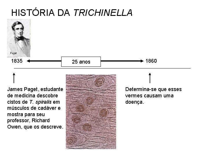 HISTÓRIA DA TRICHINELLA 1835 James Paget, estudante de medicina descobre cistos de T. spiralis HISTÓRIA DA TRICHINELLA 1835 James Paget, estudante de medicina descobre cistos de T. spiralis