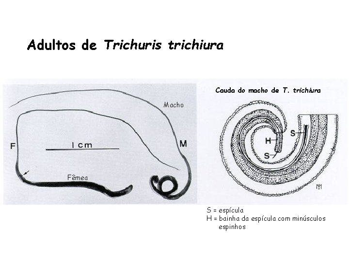 Adultos de Trichuris trichiura Cauda do macho de T. trichiura Macho Fêmea S = Adultos de Trichuris trichiura Cauda do macho de T. trichiura Macho Fêmea S =