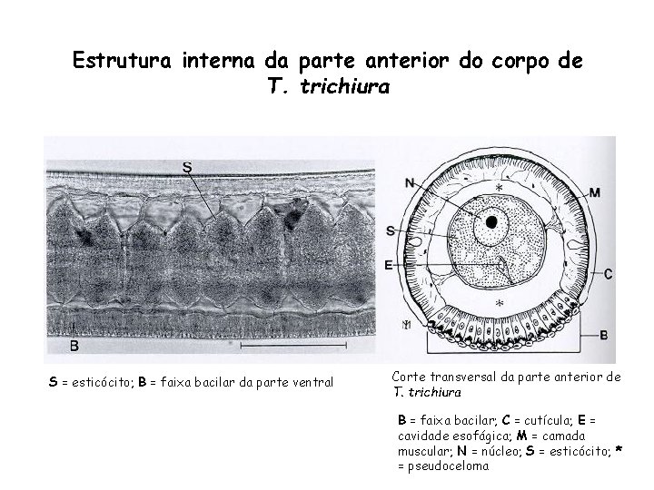 Estrutura interna da parte anterior do corpo de T. trichiura S = esticócito; B Estrutura interna da parte anterior do corpo de T. trichiura S = esticócito; B