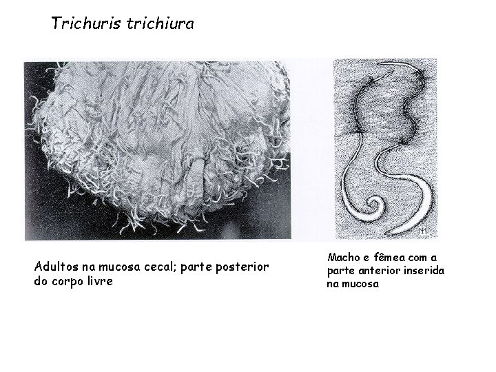Trichuris trichiura Adultos na mucosa cecal; parte posterior do corpo livre Macho e fêmea Trichuris trichiura Adultos na mucosa cecal; parte posterior do corpo livre Macho e fêmea