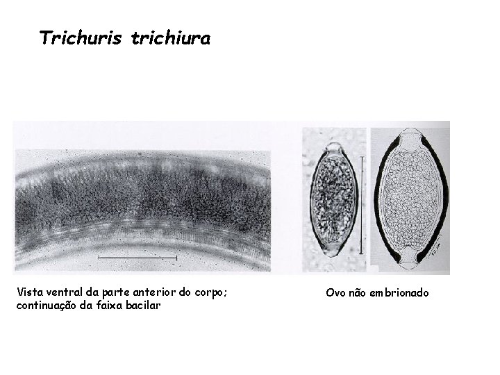 Trichuris trichiura Vista ventral da parte anterior do corpo; continuação da faixa bacilar Ovo Trichuris trichiura Vista ventral da parte anterior do corpo; continuação da faixa bacilar Ovo