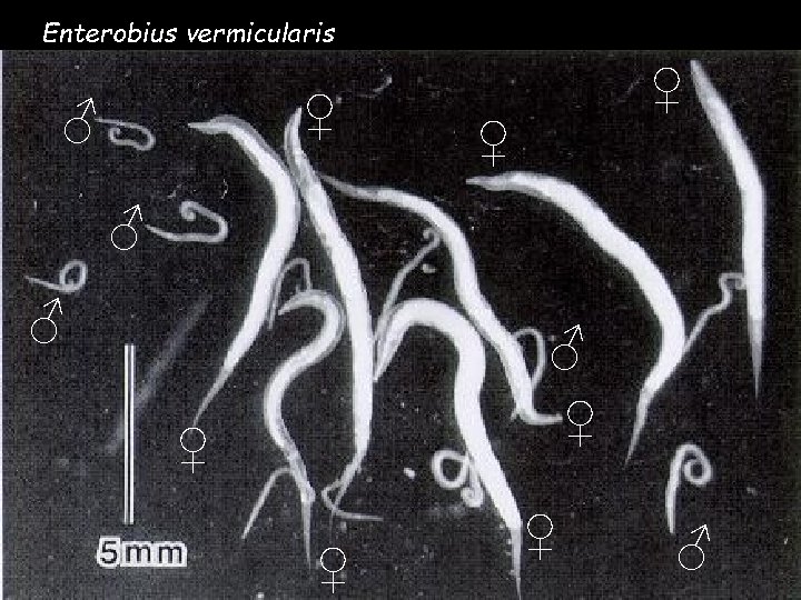 Enterobius vermicularis ♀ ♂ ♀ ♀ ♂ ♂ ♂ ♀ ♀ ♂ Enterobius vermicularis ♀ ♂ ♀ ♀ ♂ ♂ ♂ ♀ ♀ ♂