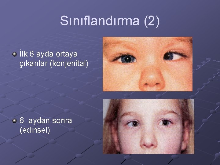 Sınıflandırma (2) İlk 6 ayda ortaya çıkanlar (konjenital) 6. aydan sonra (edinsel) 