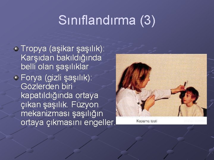 Sınıflandırma (3) Tropya (aşikar şaşılık): Karşıdan bakıldığında belli olan şaşılıklar Forya (gizli şaşılık): Gözlerden