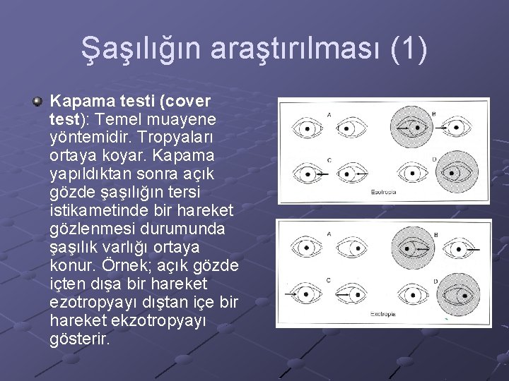 Şaşılığın araştırılması (1) Kapama testi (cover test): Temel muayene yöntemidir. Tropyaları ortaya koyar. Kapama