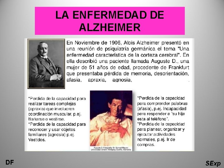 LA ENFERMEDAD DE ALZHEIMER DF SExp 