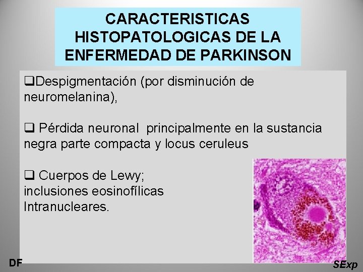 CARACTERISTICAS HISTOPATOLOGICAS DE LA ENFERMEDAD DE PARKINSON q. Despigmentación (por disminución de neuromelanina), q