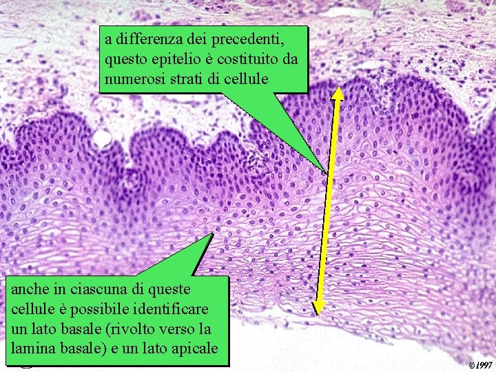 a differenza deiesofago precedenti, questo epitelio è costituito da numerosi strati di cellule anche