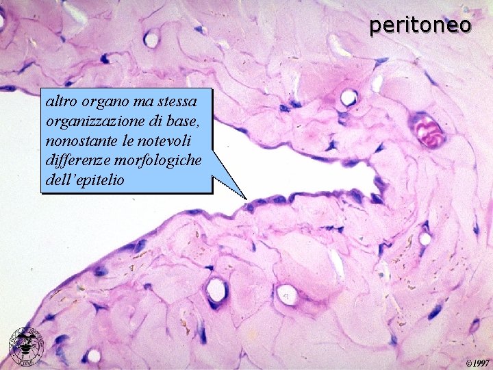 peritoneo altro organo ma stessa organizzazione di base, nonostante le notevoli differenze morfologiche dell’epitelio