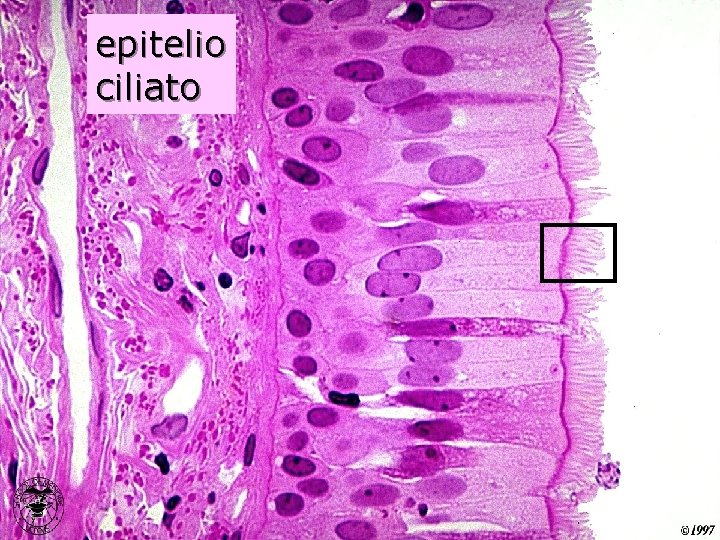 epitelio ciliato 