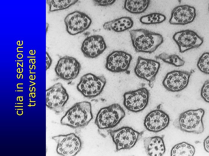 cilia in sezione trasversale 