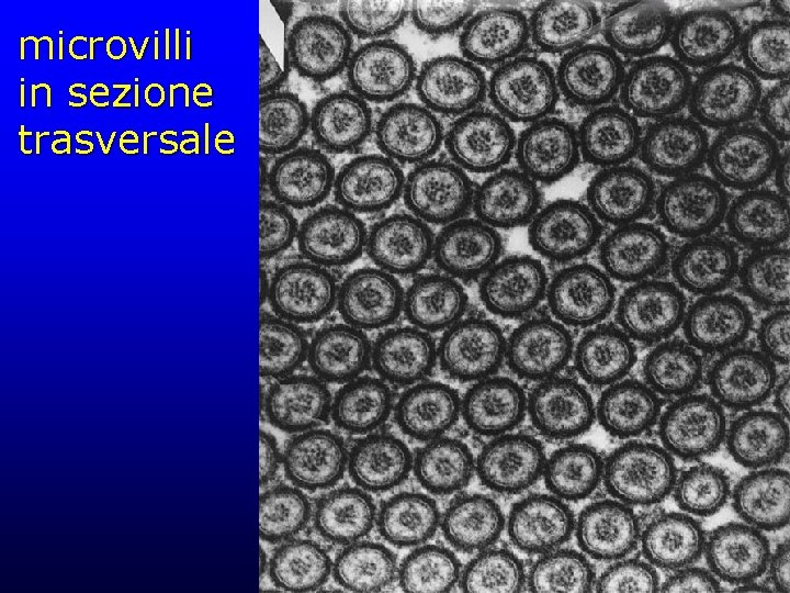 microvilli in sezione trasversale 