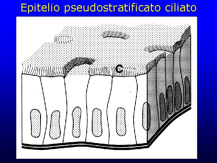 Epitelio pseudostratificato ciliato 