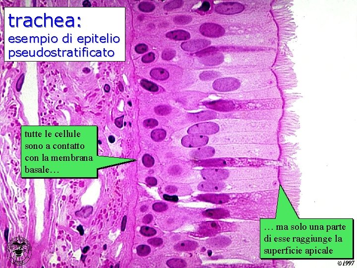 trachea: esempio di epitelio pseudostratificato tutte le cellule sono a contatto con la membrana