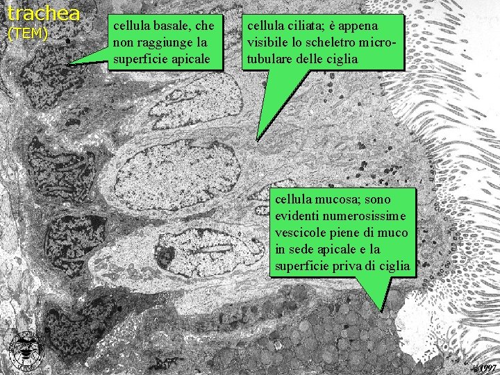 trachea (TEM) cellula basale, che non raggiunge la superficie apicale cellula ciliata; è appena