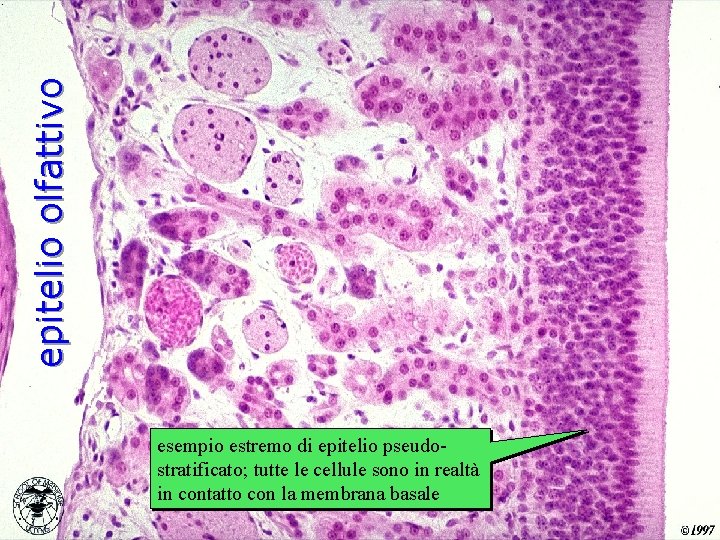epitelio olfattivo esempio estremo di epitelio pseudostratificato; tutte le cellule sono in realtà in