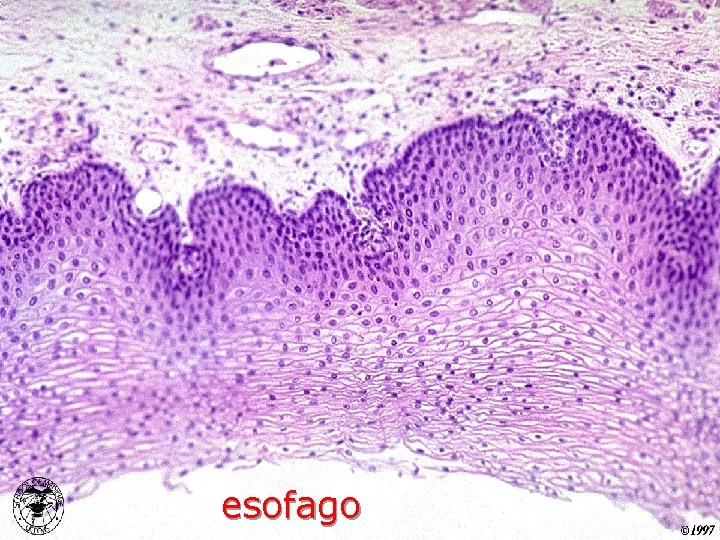 esofago 