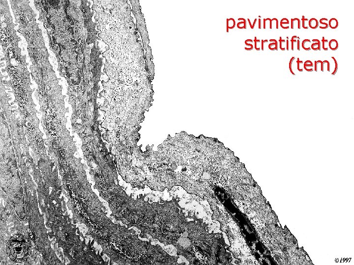 pavimentoso stratificato (tem) 