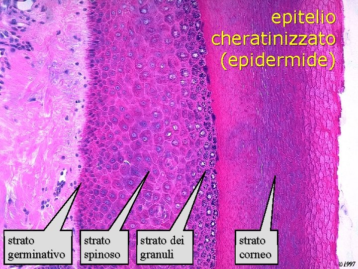 epitelio cheratinizzato (epidermide) strato germinativo strato spinoso strato dei granuli strato corneo 