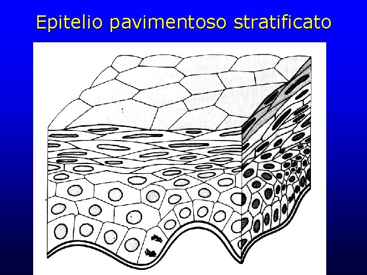 Epitelio pavimentoso stratificato 