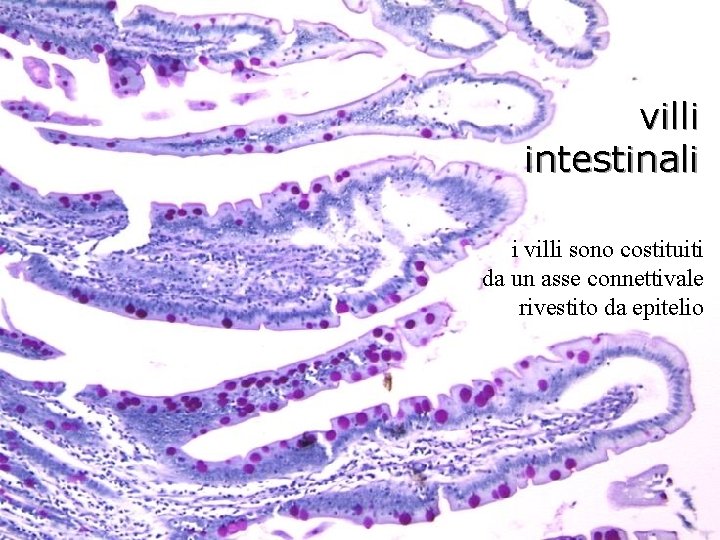 villi intestinali i villi sono costituiti da un asse connettivale rivestito da epitelio 
