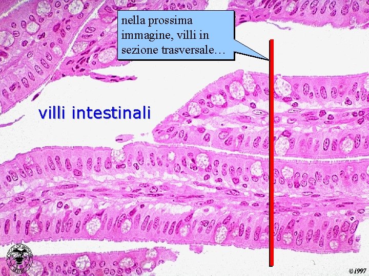 nella prossima immagine, villi in sezione trasversale… villi intestinali 