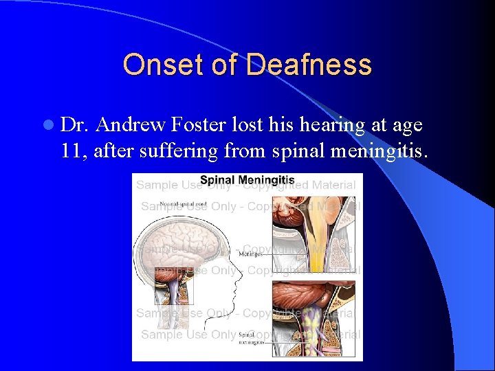 Onset of Deafness l Dr. Andrew Foster lost his hearing at age 11, after Onset of Deafness l Dr. Andrew Foster lost his hearing at age 11, after