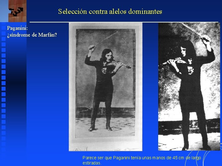 Selección contra alelos dominantes Paganini: ¿síndrome de Marfán? Parece ser que Paganini tenía unas