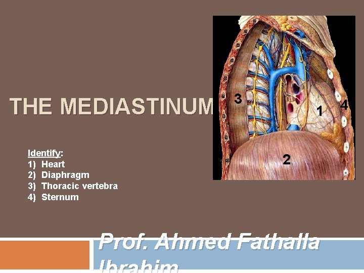 THE MEDIASTINUM Identify: 1) Heart 2) Diaphragm 3) Thoracic vertebra 4) Sternum 3 1 THE MEDIASTINUM Identify: 1) Heart 2) Diaphragm 3) Thoracic vertebra 4) Sternum 3 1