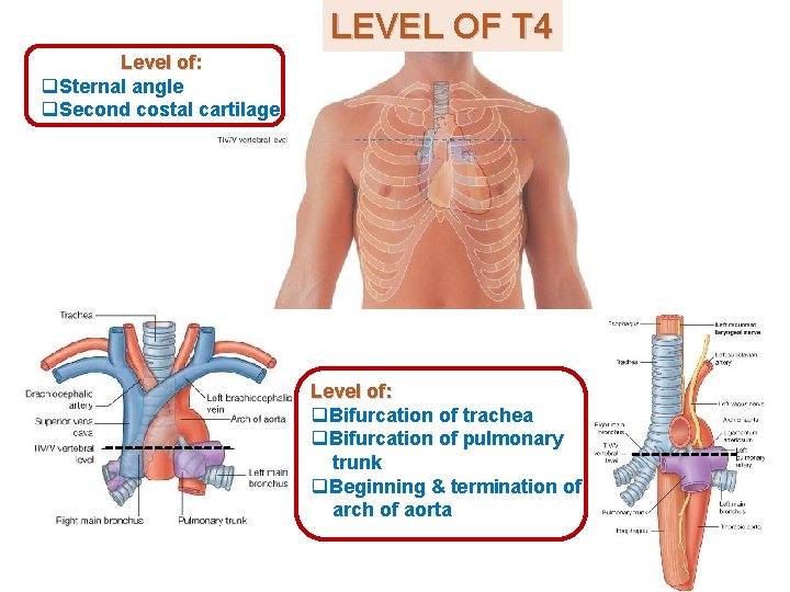 LEVEL OF T 4 Level of: q. Sternal angle q. Second costal cartilage Level LEVEL OF T 4 Level of: q. Sternal angle q. Second costal cartilage Level