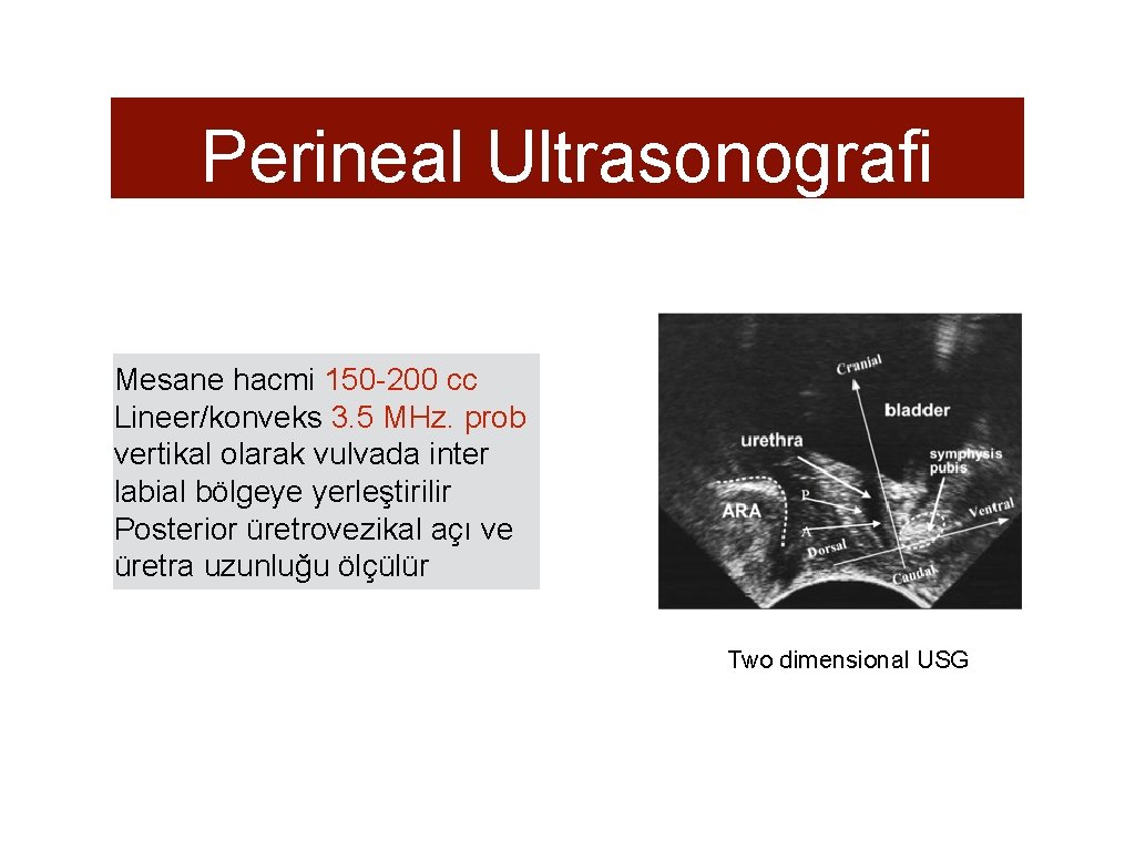 Perineal Ultrasonografi Mesane hacmi 150 -200 cc Lineer/konveks 3. 5 MHz. prob vertikal olarak