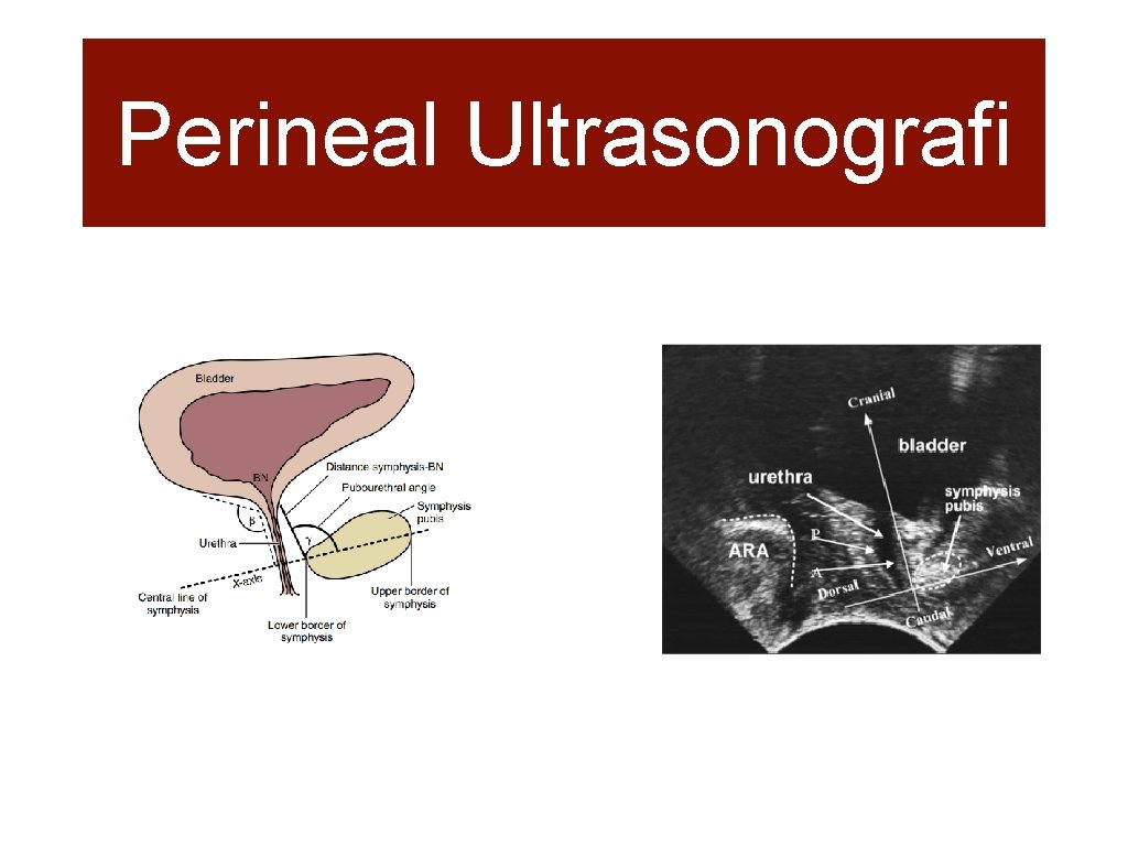 Perineal Ultrasonografi 