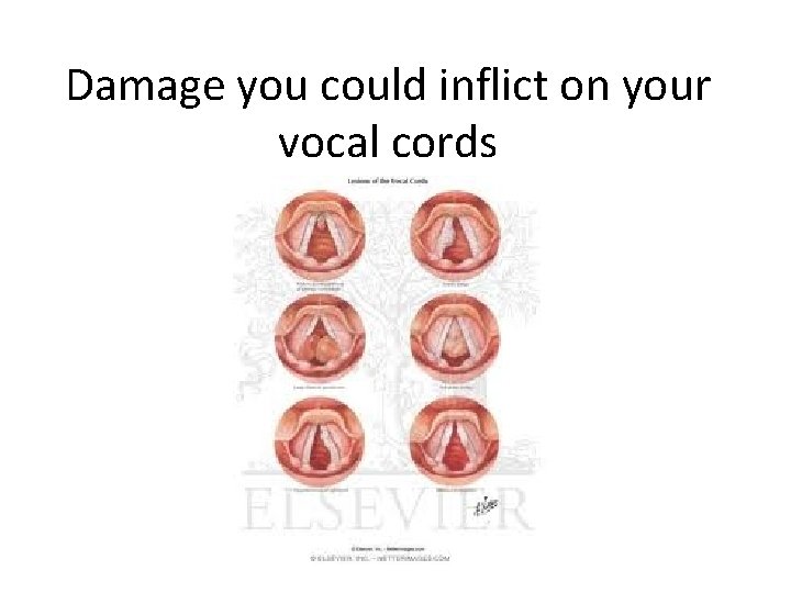 Damage you could inflict on your vocal cords 
