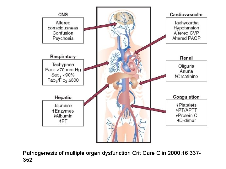 Pathogenesis of multiple organ dysfunction Crit Care Clin 2000; 16: 337352 