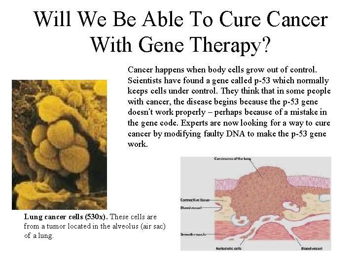 Will We Be Able To Cure Cancer With Gene Therapy? Cancer happens when body