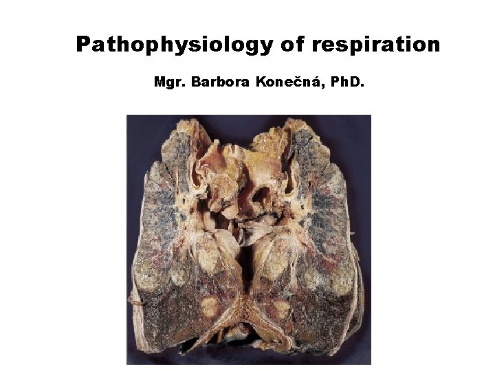 Pathophysiology of respiration Mgr. Barbora Konečná, Ph. D. 