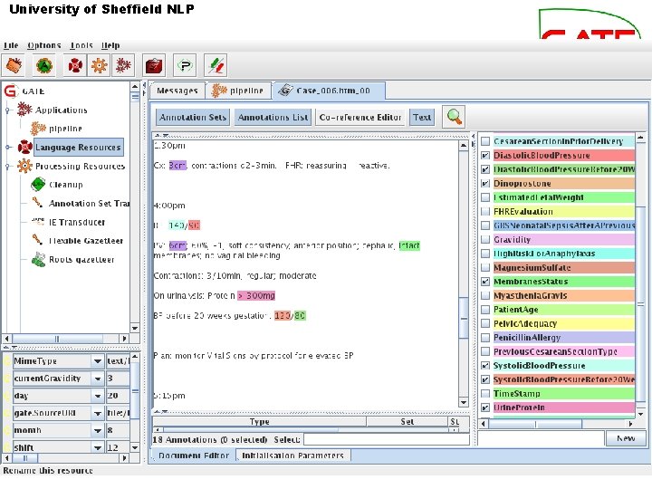 University of Sheffield NLP Obstetrics records 