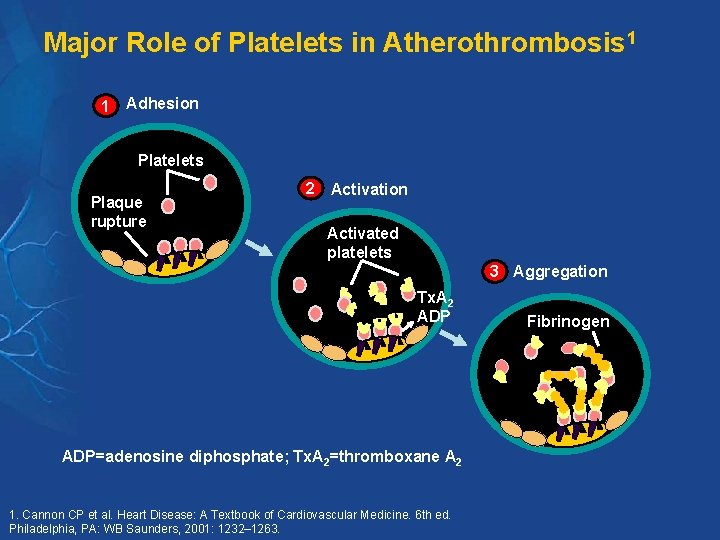 Major Role of Platelets in Atherothrombosis 1 1 Adhesion Platelets Plaque rupture 2 Activation