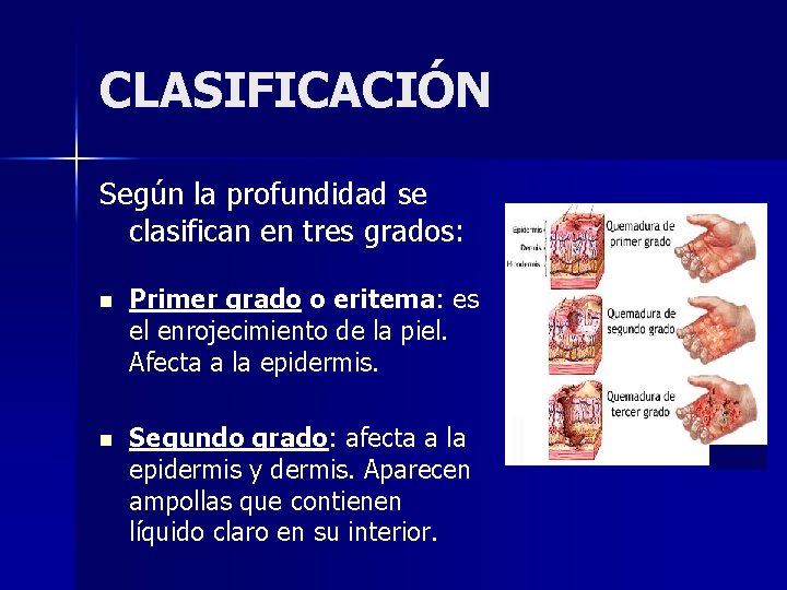 CLASIFICACIÓN Según la profundidad se clasifican en tres grados: n Primer grado o eritema: