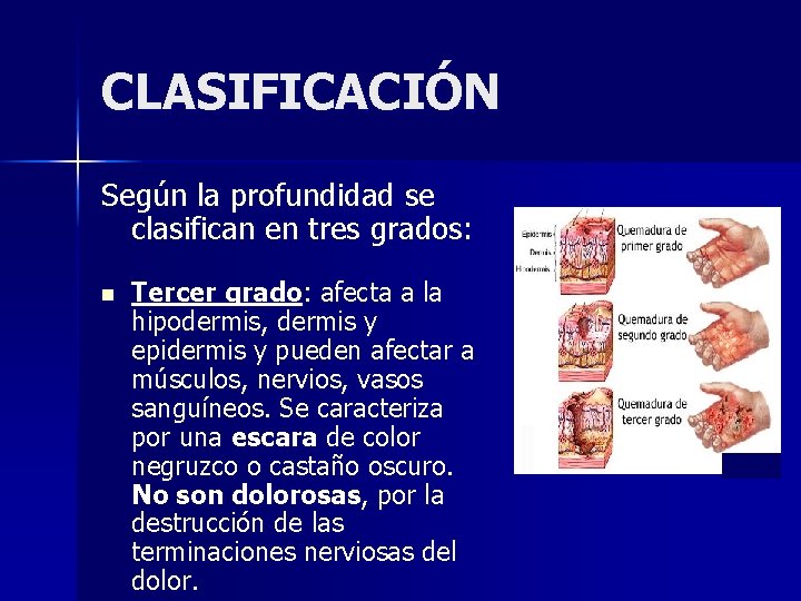 CLASIFICACIÓN Según la profundidad se clasifican en tres grados: n Tercer grado: afecta a