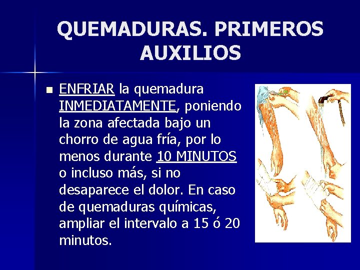 QUEMADURAS. PRIMEROS AUXILIOS n ENFRIAR la quemadura INMEDIATAMENTE, poniendo la zona afectada bajo un