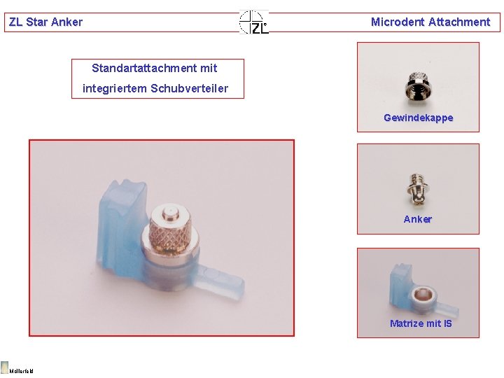 ZL Star Anker Microdent Attachment Standartattachment mit integriertem Schubverteiler Gewindekappe Anker Matrize mit IS