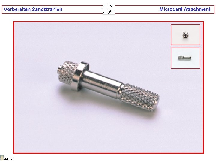Vorbereiten Sandstrahlen Möllerfeld Microdent Attachment 