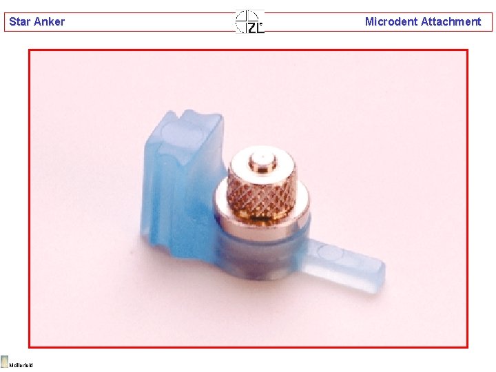 Star Anker Möllerfeld Microdent Attachment 