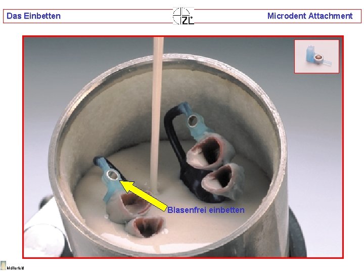 Das Einbetten Microdent Attachment Blasenfrei einbetten Möllerfeld 