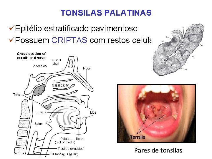 TONSILAS PALATINAS üEpitélio estratificado pavimentoso üPossuem CRIPTAS com restos celulares Pares de tonsilas TONSILAS PALATINAS üEpitélio estratificado pavimentoso üPossuem CRIPTAS com restos celulares Pares de tonsilas