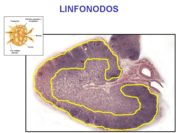 LINFONODOS LINFONODOS