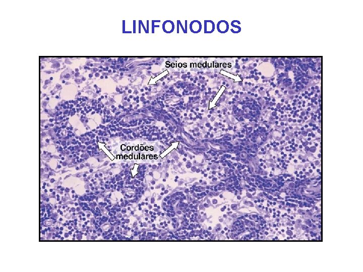 LINFONODOS LINFONODOS