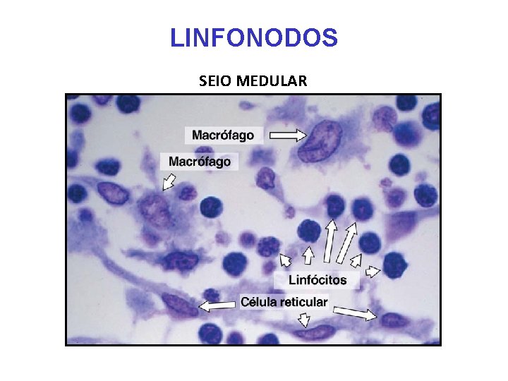LINFONODOS SEIO MEDULAR LINFONODOS SEIO MEDULAR